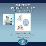 Cerkes Rhinoplasty Video Library