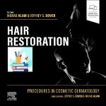Procedures in Cosmetic Dermatology Hair Restoration