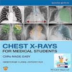 Chest X-Rays for Medical Students 2ed