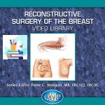 Reconstructive Surgery of the Breast