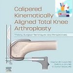 Calipered Kinematically aligned Total Knee Arthroplasty TRUE PDF+VIDEOS Price 4€