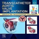 Transcatheter Aortic Valve Implantation TRUE PDF + VIDEOS Price 9€